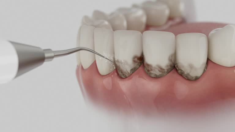 Trusted Dental Implants service in Morgantown, WV - Dentist Open Now